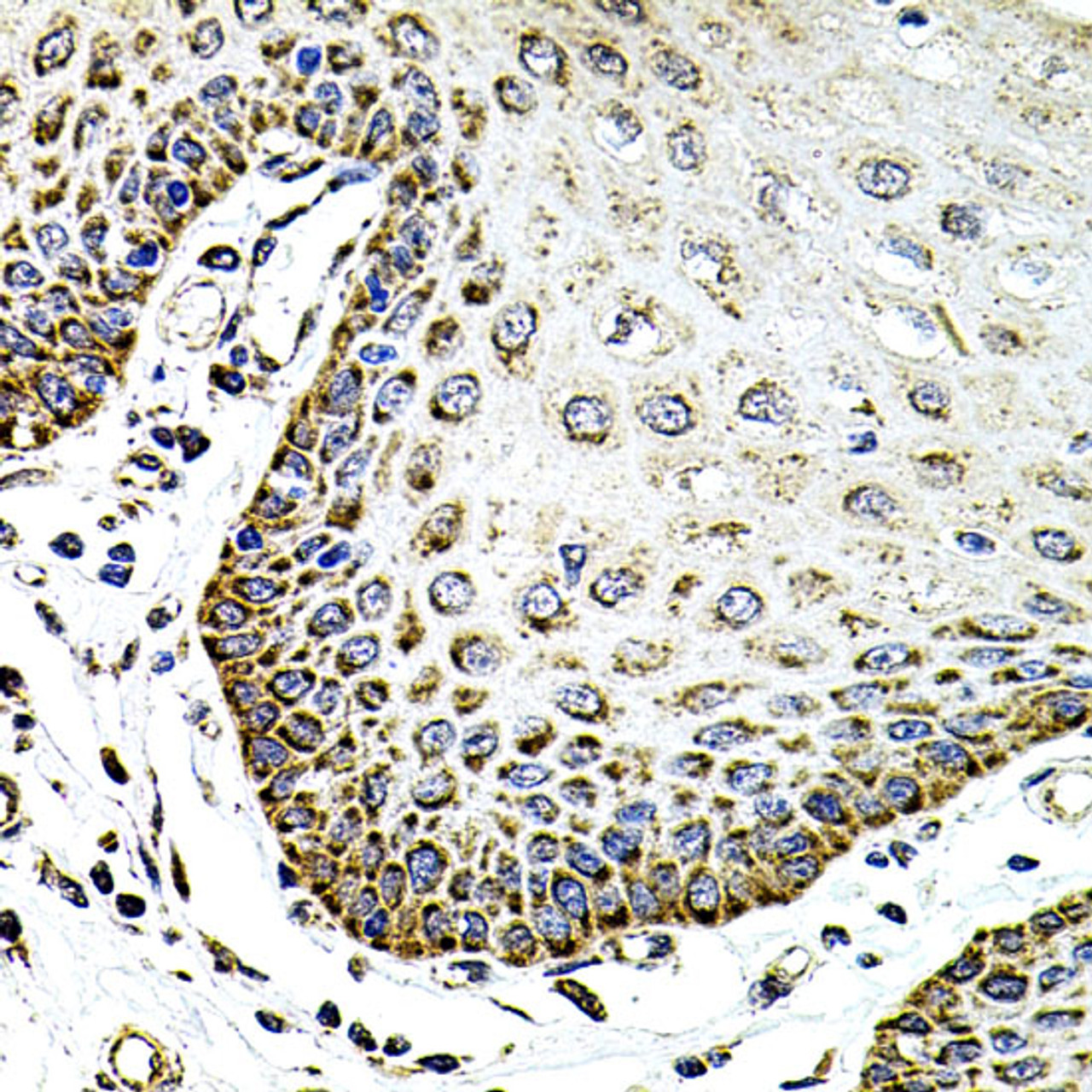 Immunohistochemistry of paraffin-embedded Human esophagus using SDC2 Polyclonal Antibody at dilution of  1:100 (40x lens).