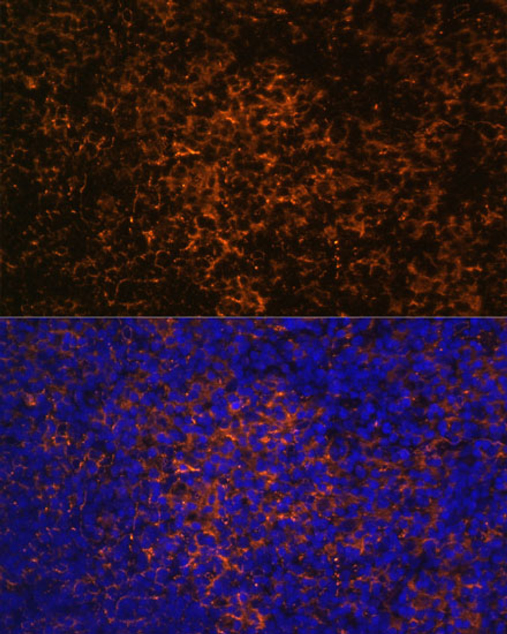 Immunofluorescence analysis of Rat thymus using ICOS Polyclonal Antibody at dilution of  1:100. Blue: DAPI for nuclear staining.