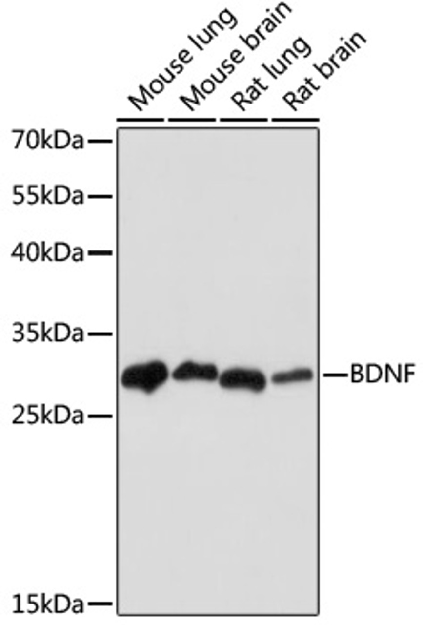 Western blot analysis of extracts of various cell lines using BDNF Monoclonal Antibody at dilution of 1:1000.