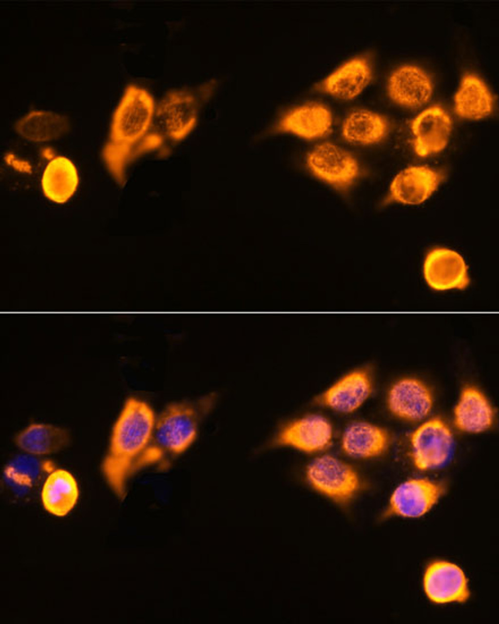 Immunofluorescence analysis of HeLa cells using ASPM Polyclonal Antibody at dilution of  1:100. Blue: DAPI for nuclear staining.