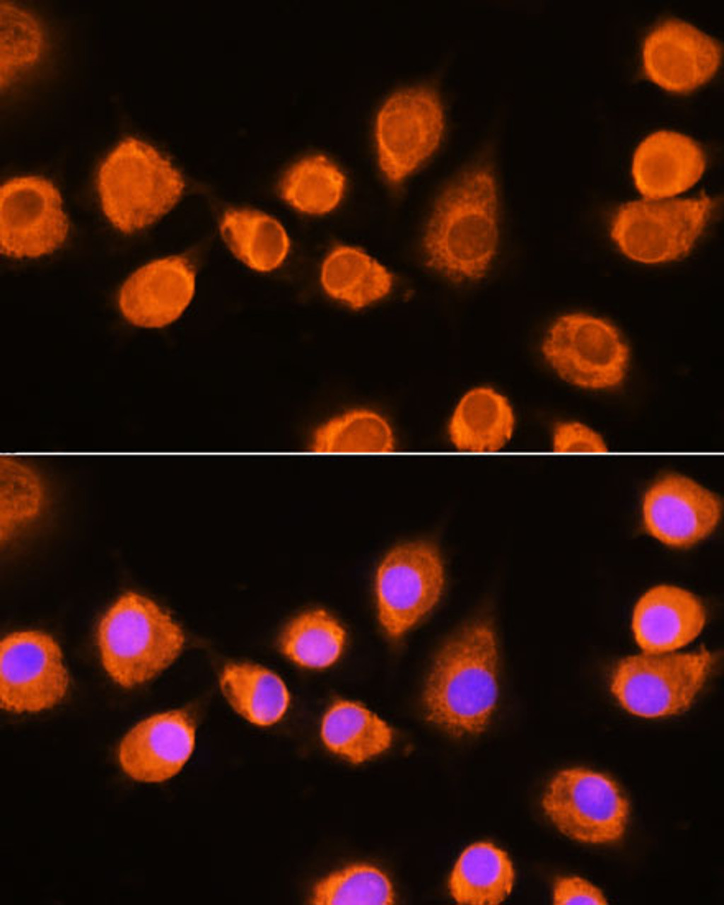 Immunofluorescence analysis of L929 cells using ASPM Polyclonal Antibody at dilution of  1:100. Blue: DAPI for nuclear staining.
