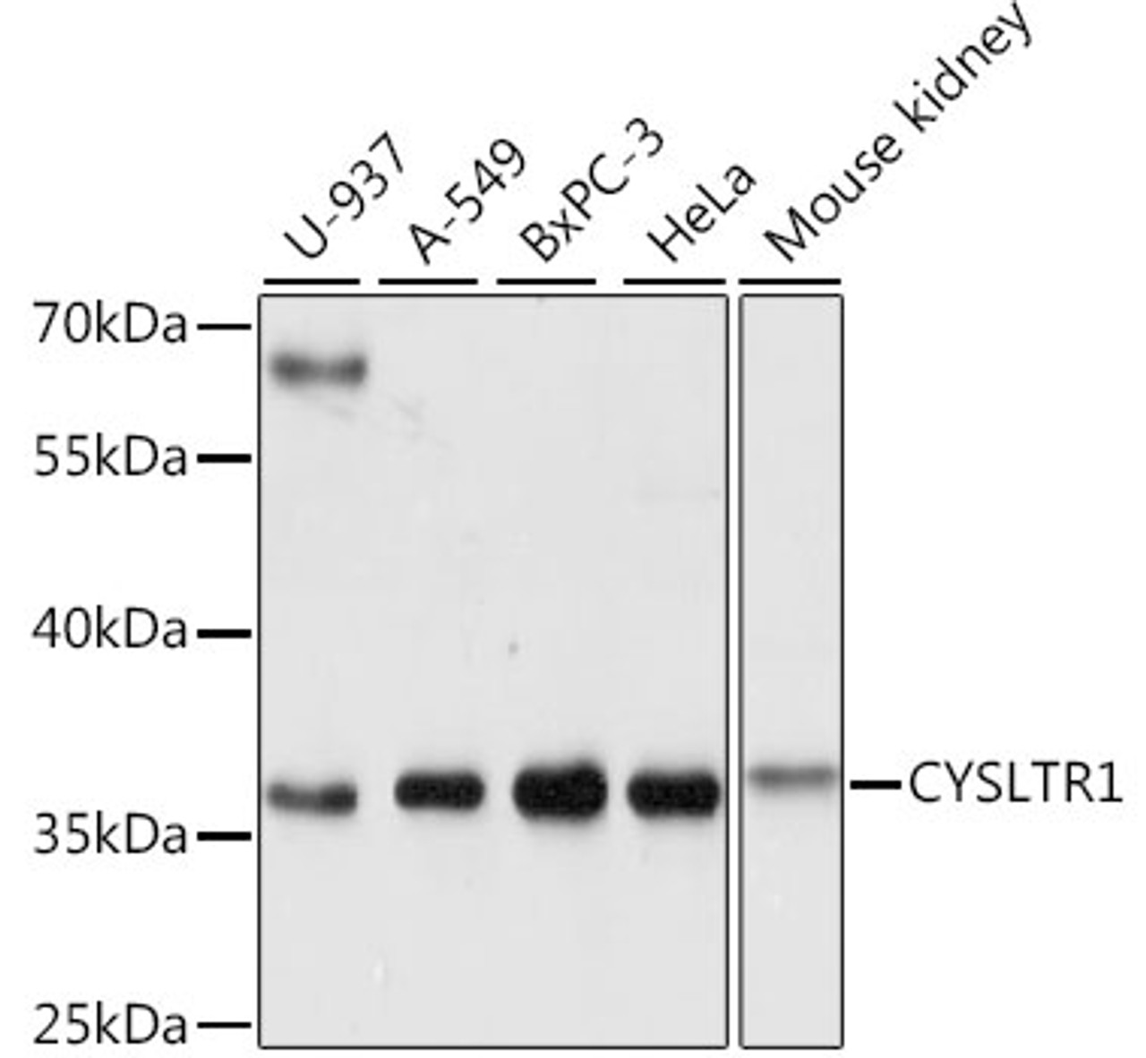 Western blot analysis of extracts of various cell lines using CYSLTR1 Polyclonal Antibody at dilution of 1:1000.