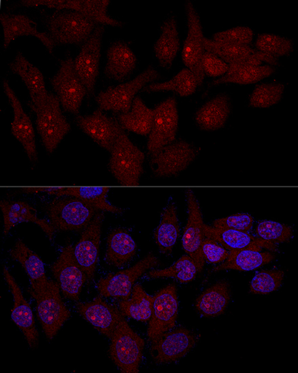 Confocal immunofluorescence analysis of Hela cells using EIF6 Polyclonal Antibody at dilution of  1:50. Blue: DAPI for nuclear staining.