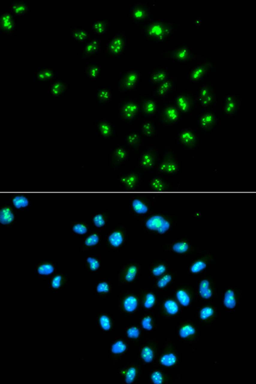 Immunofluorescence analysis of MCF-7 cells using EIF6 Polyclonal Antibody