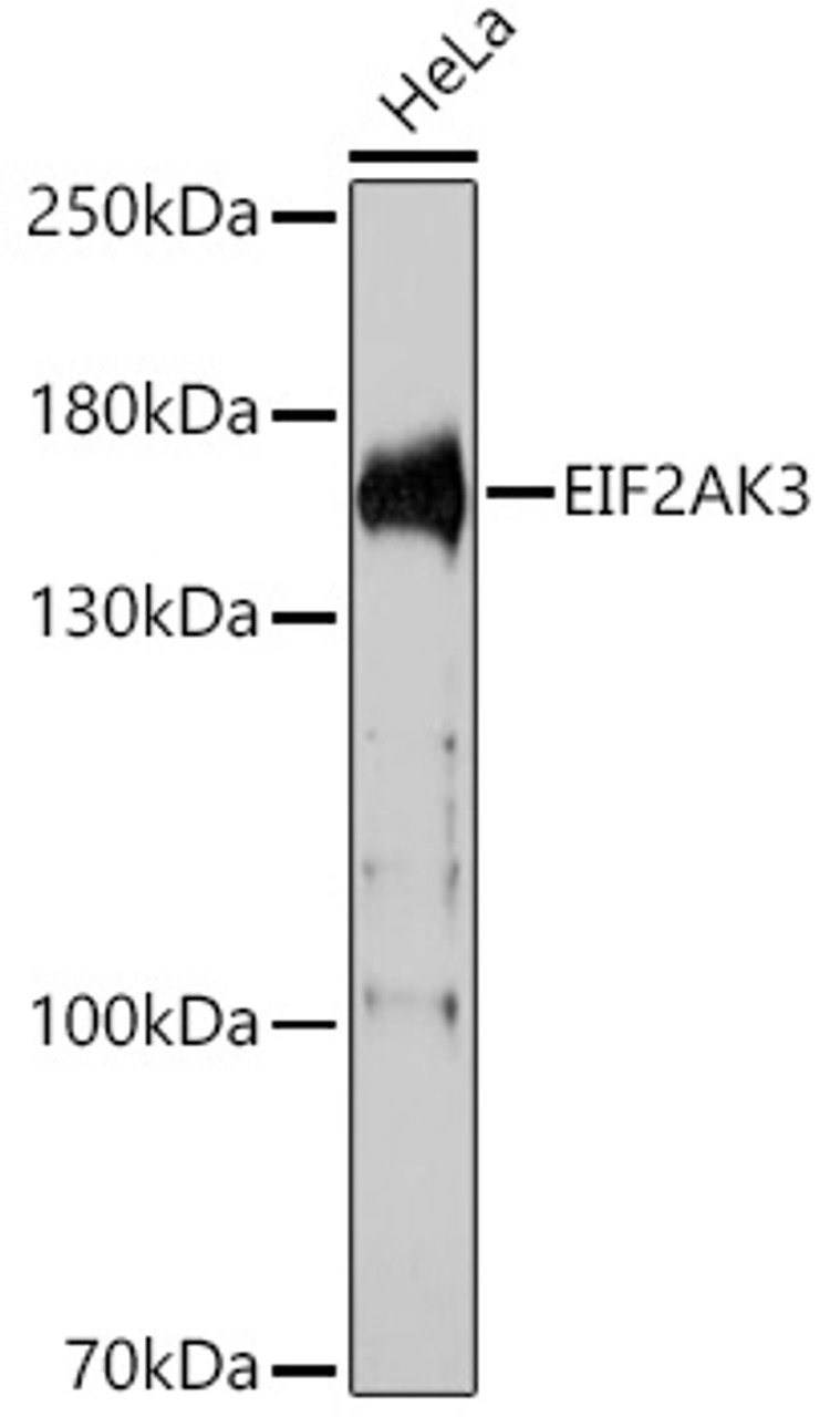 Western blot analysis of extracts of HeLa cells using EIF2AK3 Polyclonal Antibody at dilution of 1:1000.