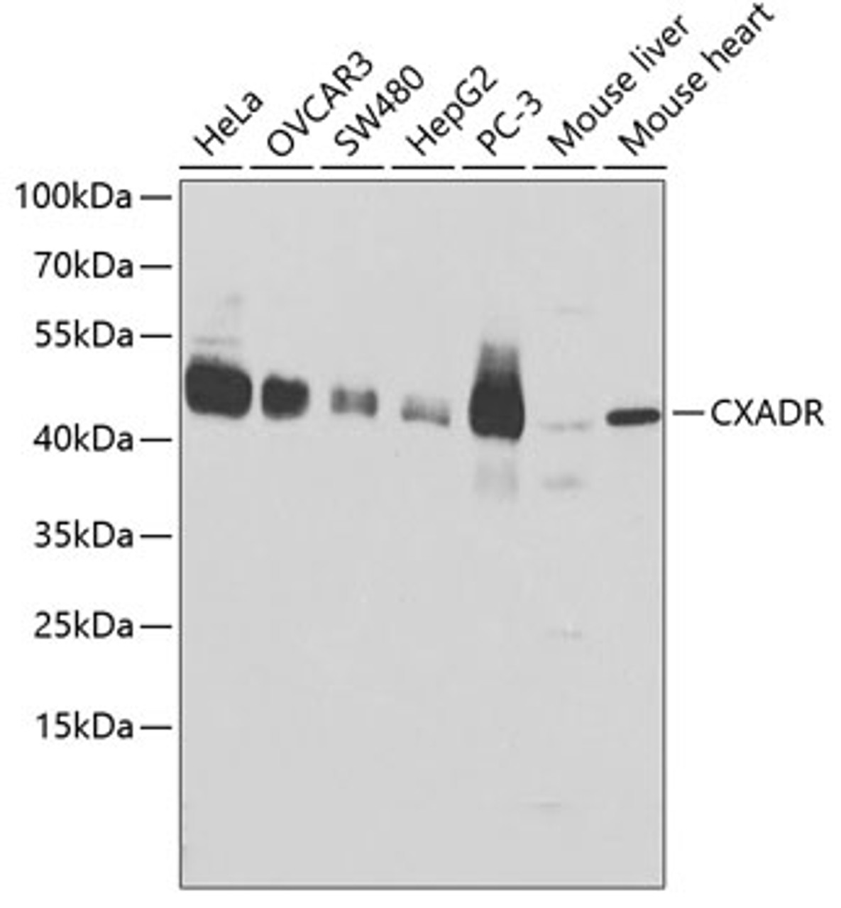 Western blot analysis of extracts of various cell lines using CXADR Polyclonal Antibody at dilution of 1:1000.