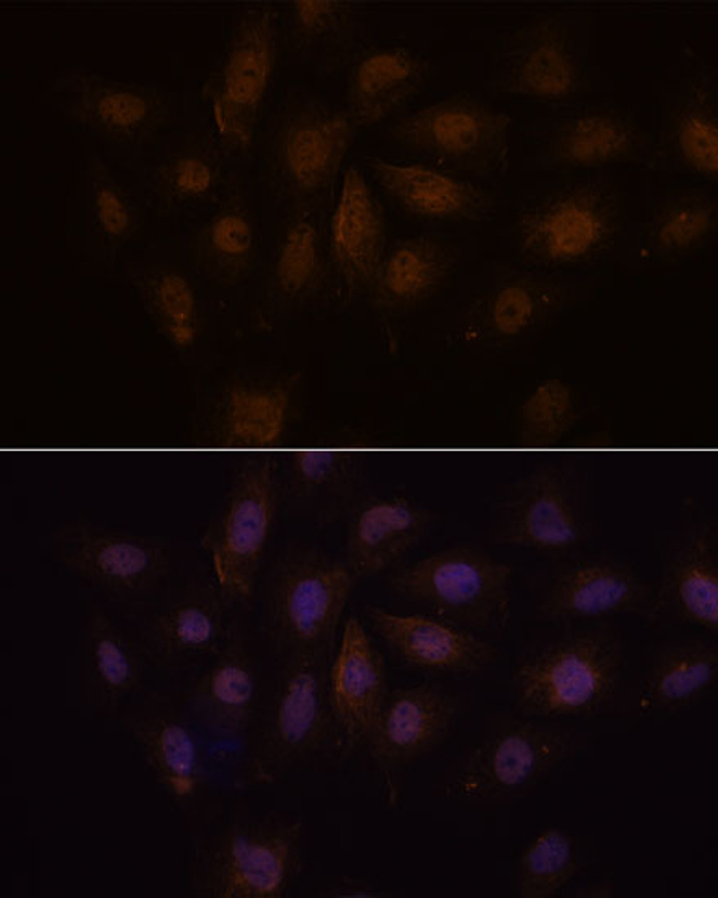 Immunofluorescence analysis of C6 cells using MED15 Polyclonal Antibody at dilution of  1:100. Blue: DAPI for nuclear staining.