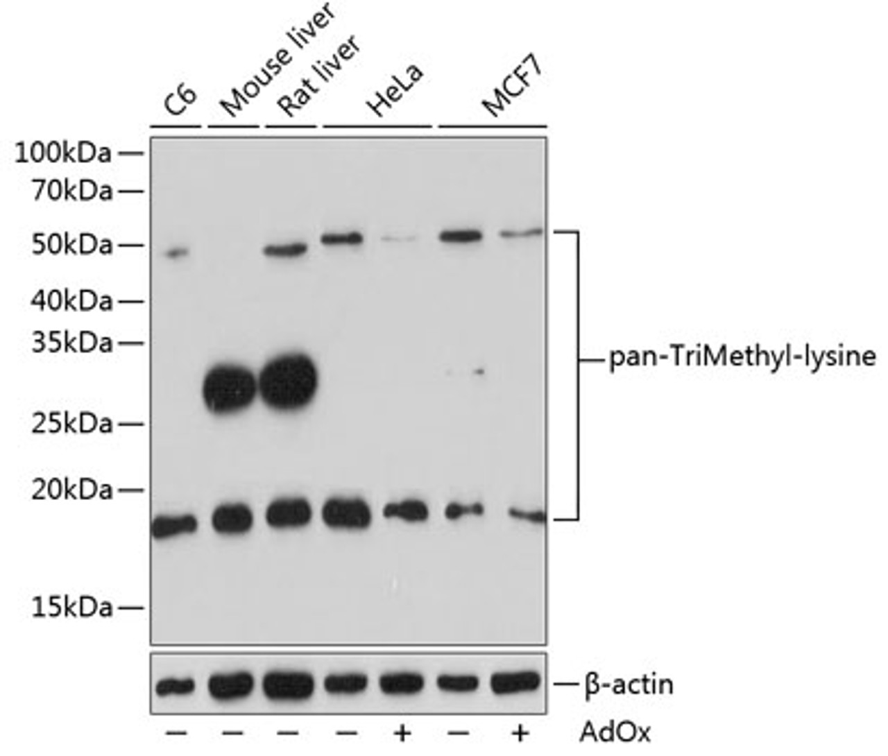 Western blot analysis of extracts of various cell lines using pan-TriMethyl-lysine Polyclonal Antibody at dilution of 1:500. HeLa and MCF7 cells were treated by ADOX (100 μM) for 24 hours.