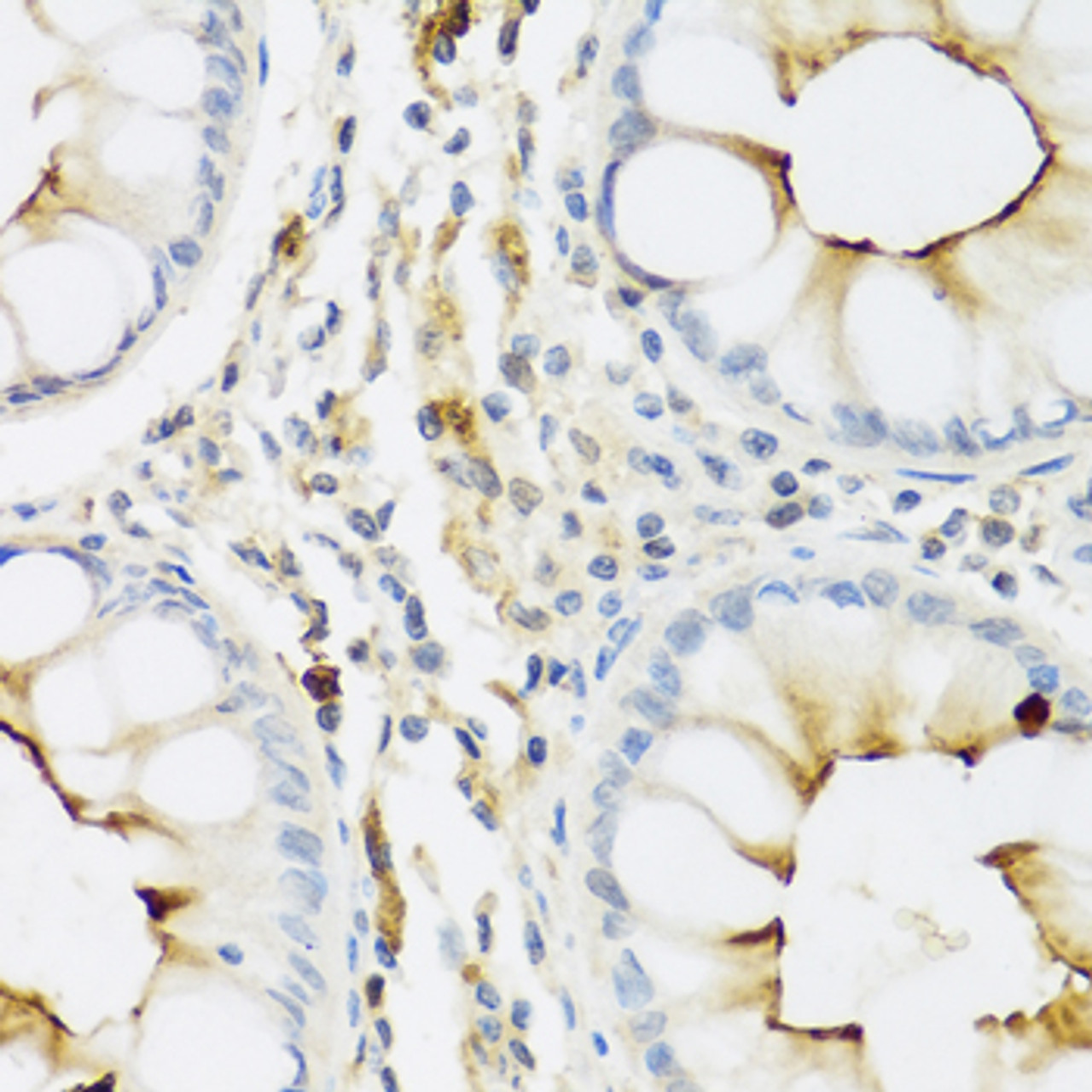 Immunohistochemistry of paraffin-embedded Human colon using RNASE3 Polyclonal Antibody at dilution of  1:100 (40x lens).