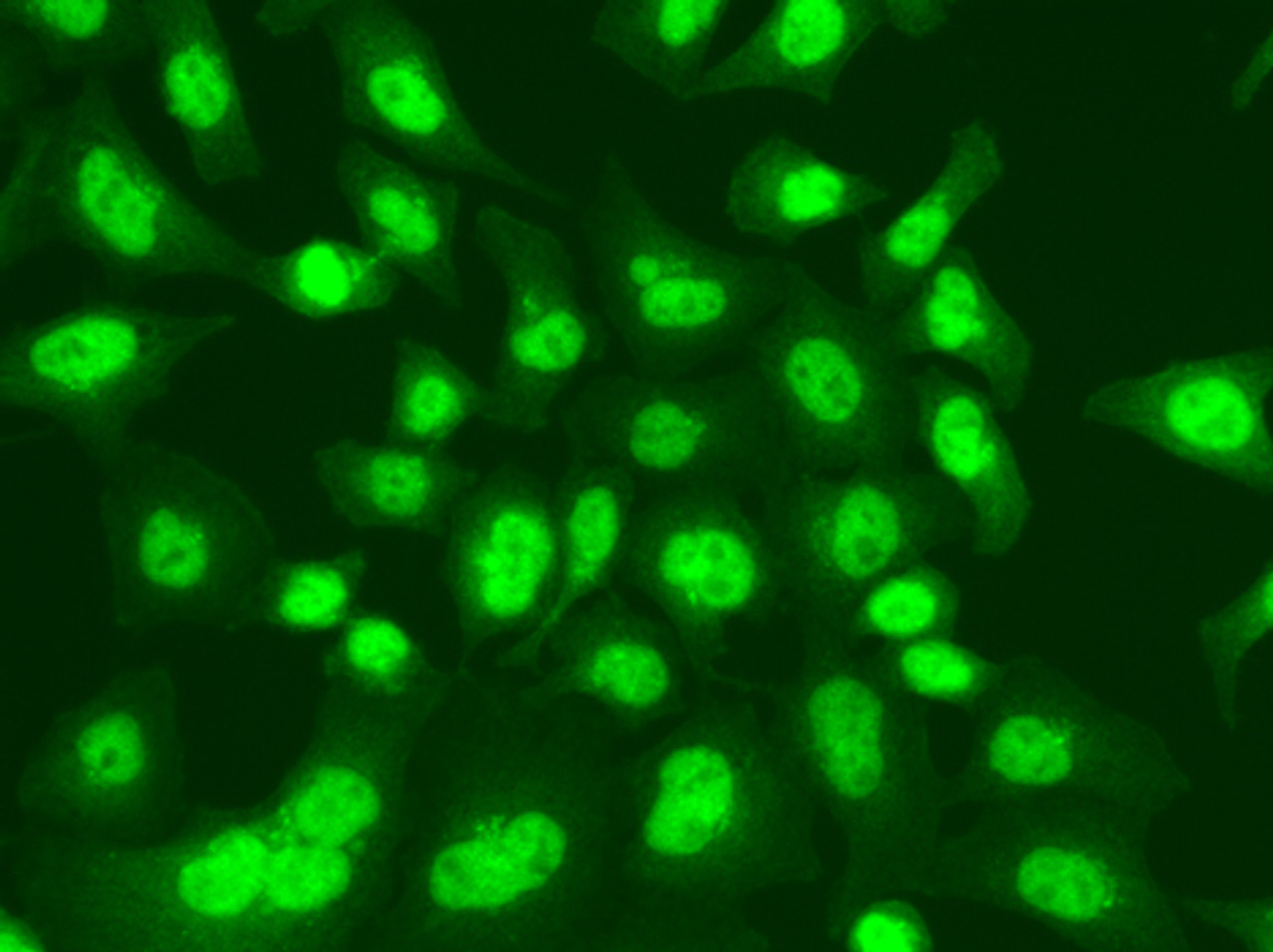 Immunofluorescence analysis of A549 cells using LIG1 Polyclonal Antibody