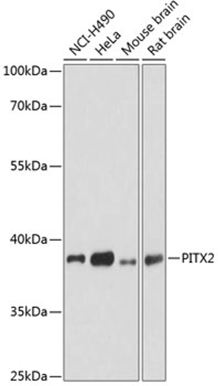 Western blot analysis of extracts of various cell lines using PITX2 Polyclonal Antibody at dilution of 1:3000.