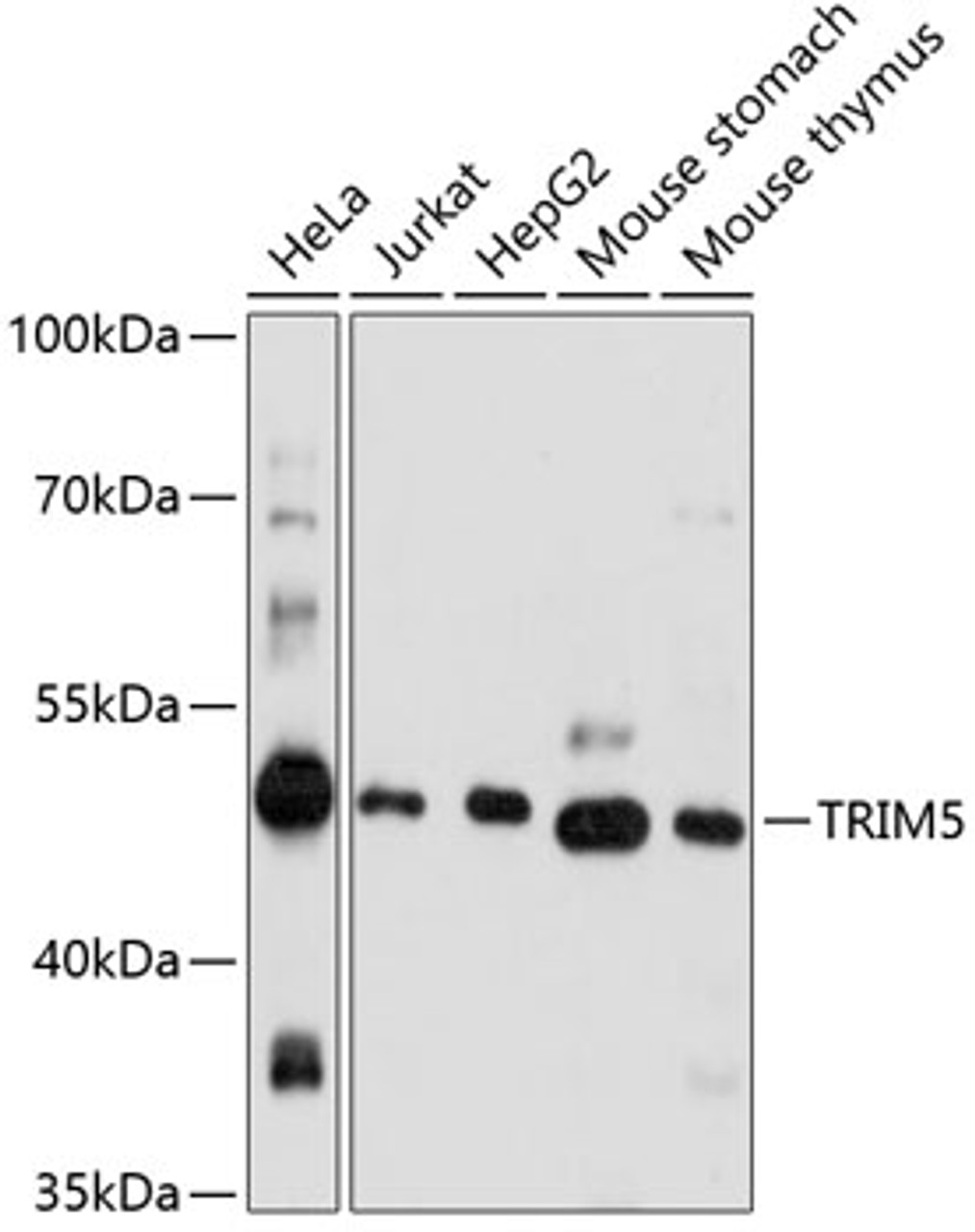 Western blot analysis of extracts of various cell lines using TRIM5 Polyclonal Antibody at dilution of 1:1000.
