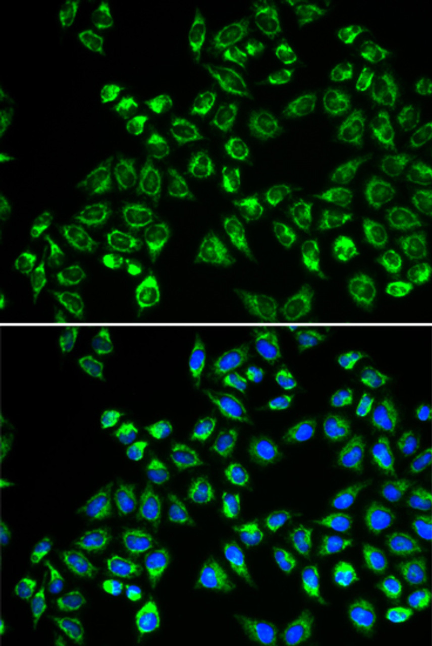 Immunofluorescence analysis of HeLa cells using C1QBP Polyclonal Antibody