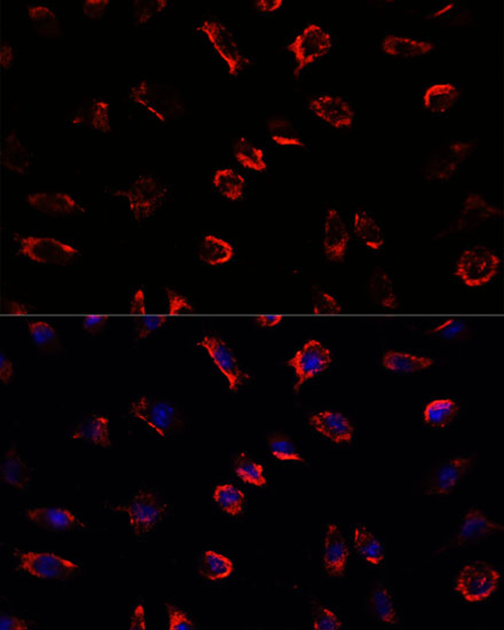 Immunofluorescence analysis of L929 cells using IL11 Polyclonal Antibody at dilution of  1:100. Blue: DAPI for nuclear staining.