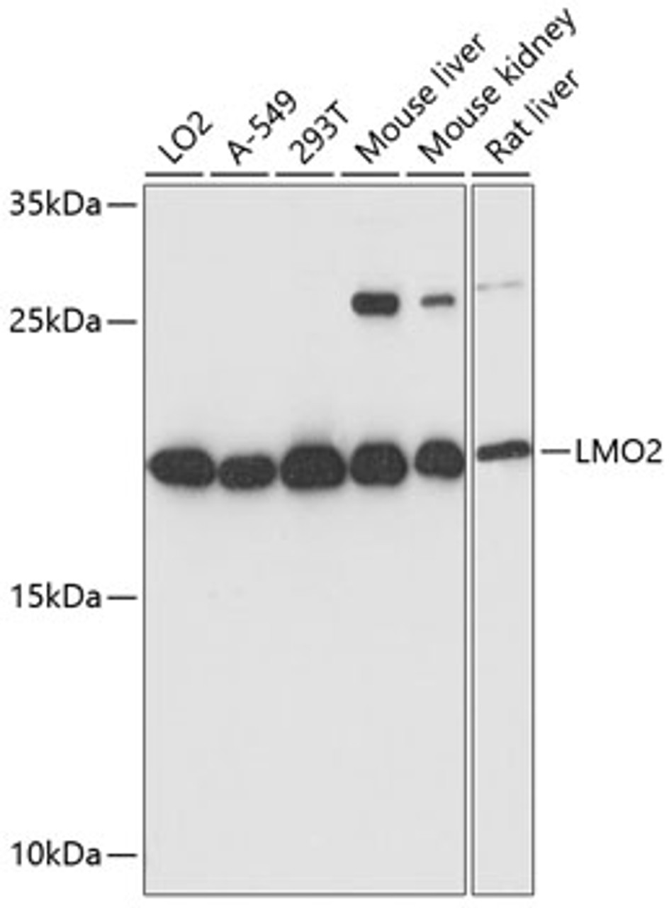 Western blot analysis of extracts of various cell lines using LMO2 Polyclonal Antibody at dilution of 1:3000.