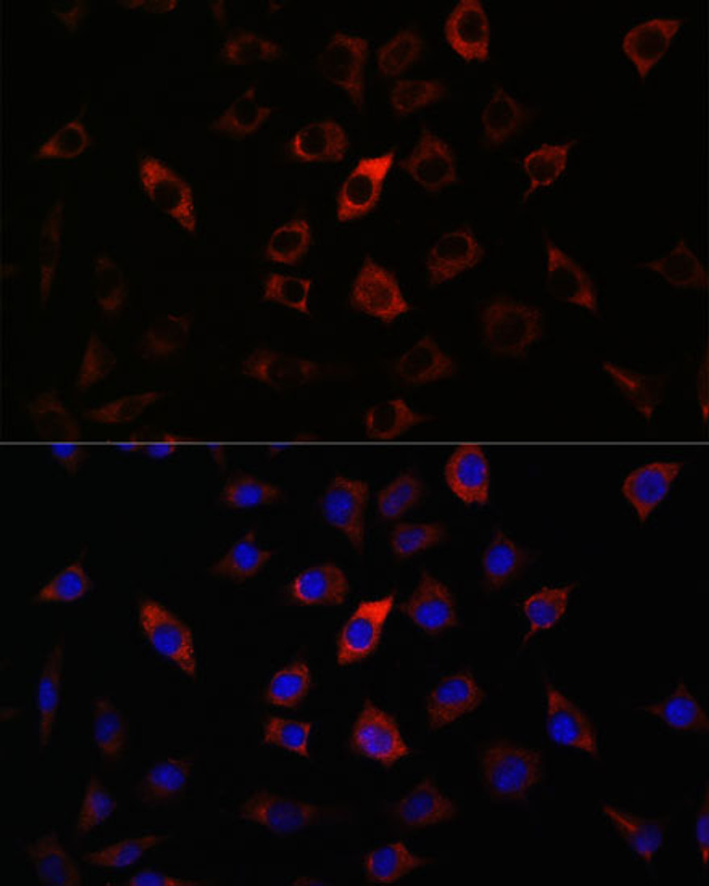 Immunofluorescence analysis of L929 cells using RAB27A Polyclonal Antibody at dilution of  1:100. Blue: DAPI for nuclear staining.