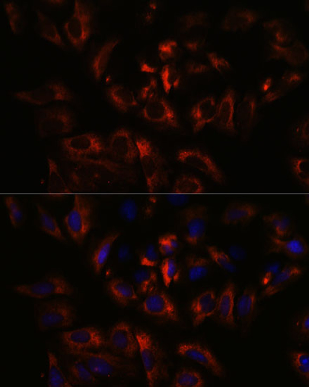 Immunofluorescence analysis of U-2 OS cells using RAB27A Polyclonal Antibody at dilution of  1:100. Blue: DAPI for nuclear staining.