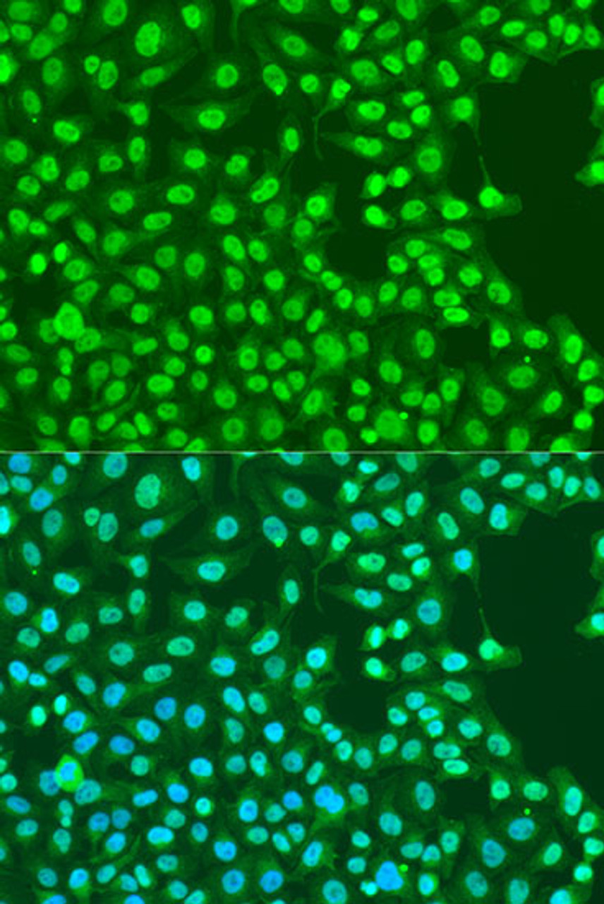 Immunofluorescence analysis of U2OS cells using EXO1 Polyclonal Antibody at dilution of  1:100. Blue: DAPI for nuclear staining.