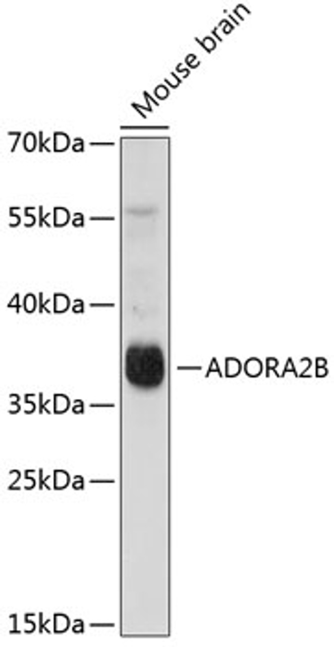 Western blot analysis of extracts of Mouse brain using ADORA2B Polyclonal Antibody at dilution of 1:1000.
