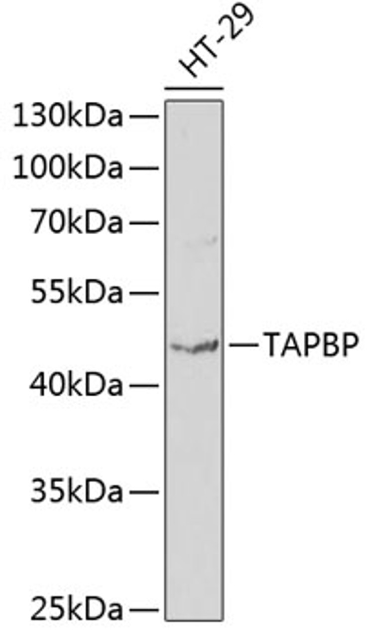 Western blot analysis of extracts of HT-29 cells using TAPBP Polyclonal Antibody at dilution of 1:1000.