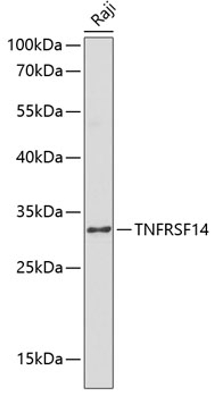 Western blot analysis of extracts of Raji cells using HVEM/TNFRSF14 Polyclonal Antibody at dilution of 1:1000.