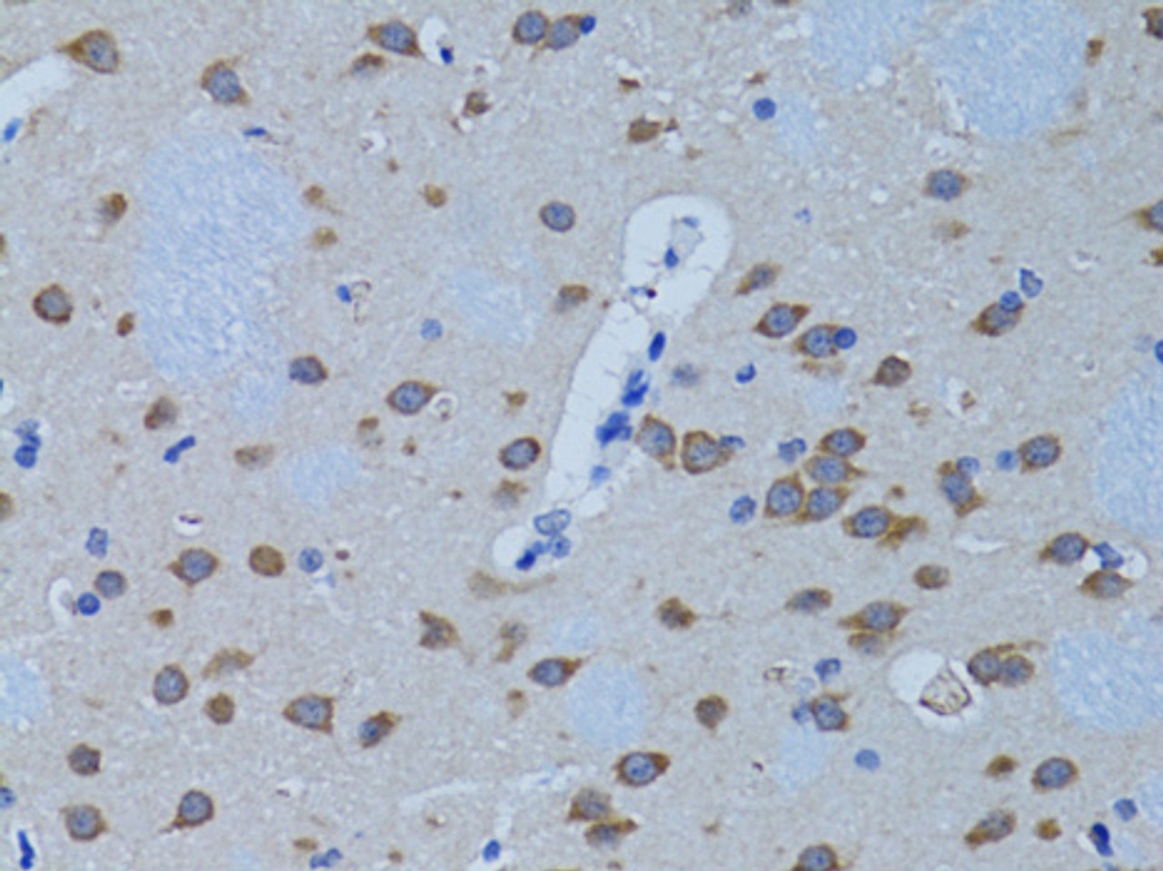 Immunohistochemistry of paraffin-embedded Rat brain using PLCB1 Polyclonal Antibody at dilution of  1:100 (40x lens).