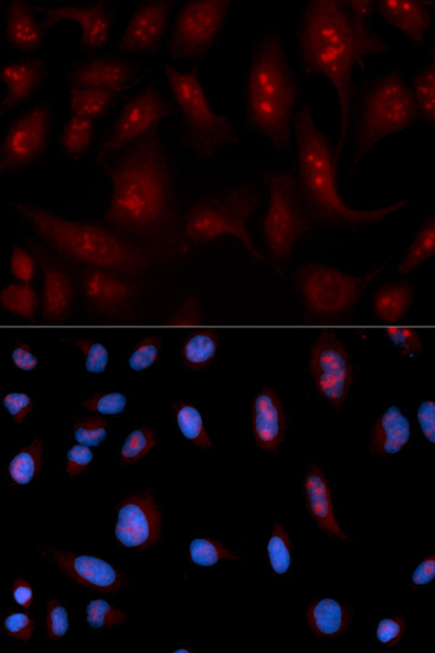 Immunofluorescence analysis of U2OS cells using PLCB1 Polyclonal Antibody
