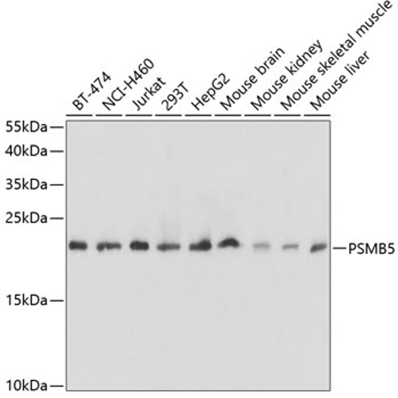 Western blot analysis of extracts of various cell lines using PSMB5 Polyclonal Antibody at dilution of 1:1000.