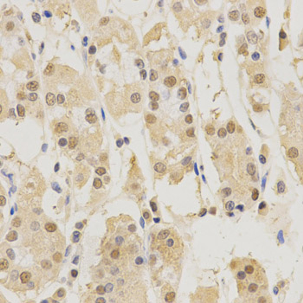 Immunohistochemistry of paraffin-embedded Human stomach using PSMB5 Polyclonal Antibody at dilution of  1:200 (40x lens).