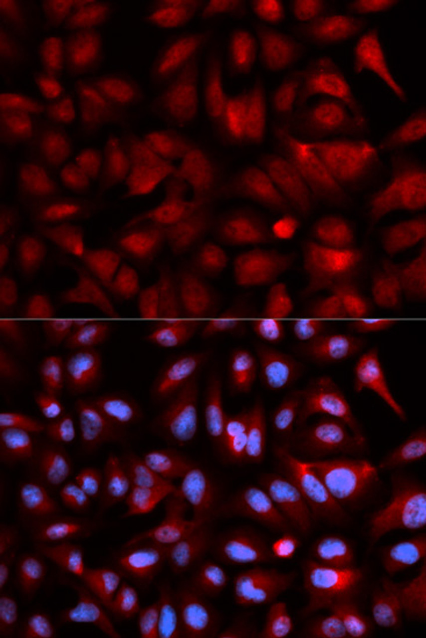 Immunofluorescence analysis of U2OS cells using PSMB5 Polyclonal Antibody