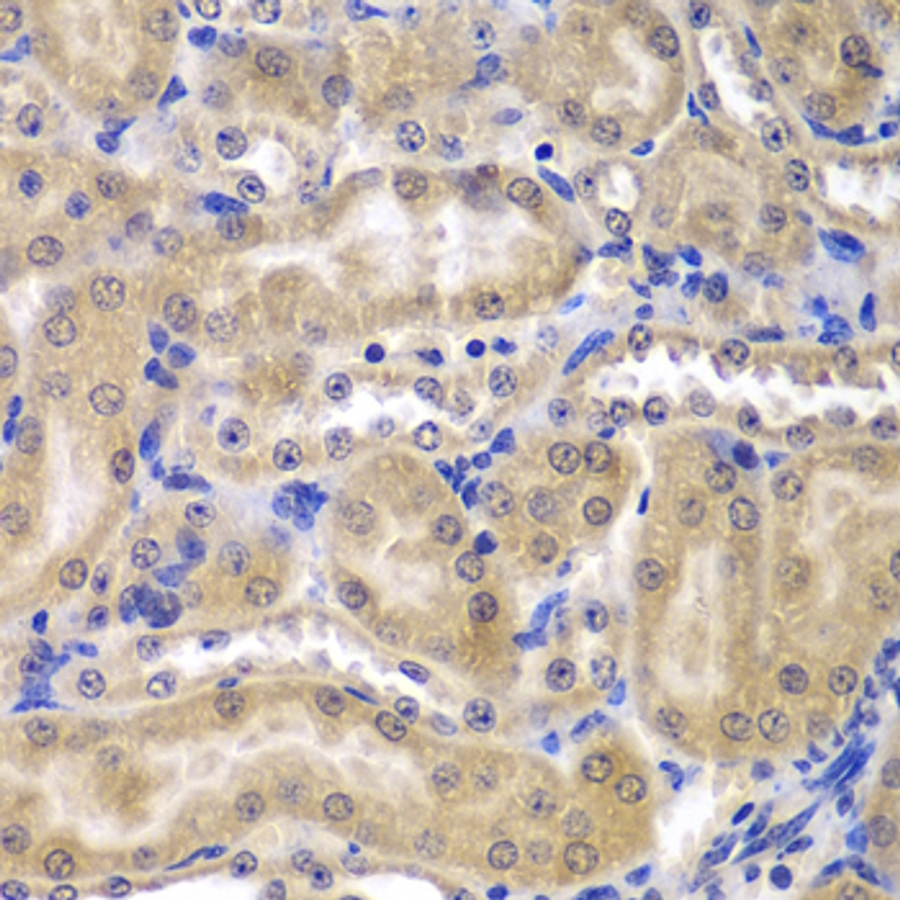 Immunohistochemistry of paraffin-embedded Mouse kidney using RPL5 Polyclonal Antibody at dilution of  1:200 (40x lens).