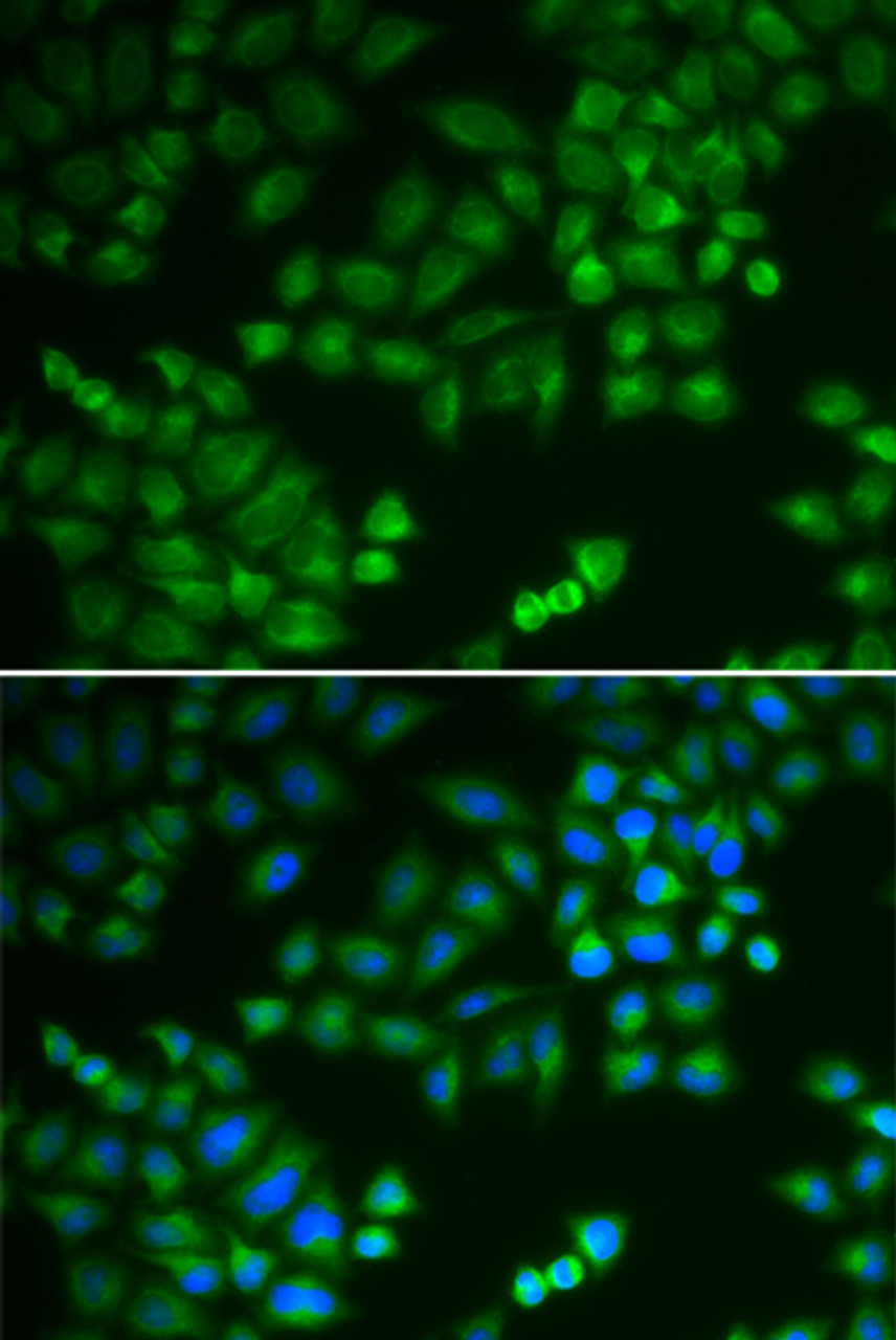 Immunofluorescence analysis of MCF-7 cells using RPL5 Polyclonal Antibody