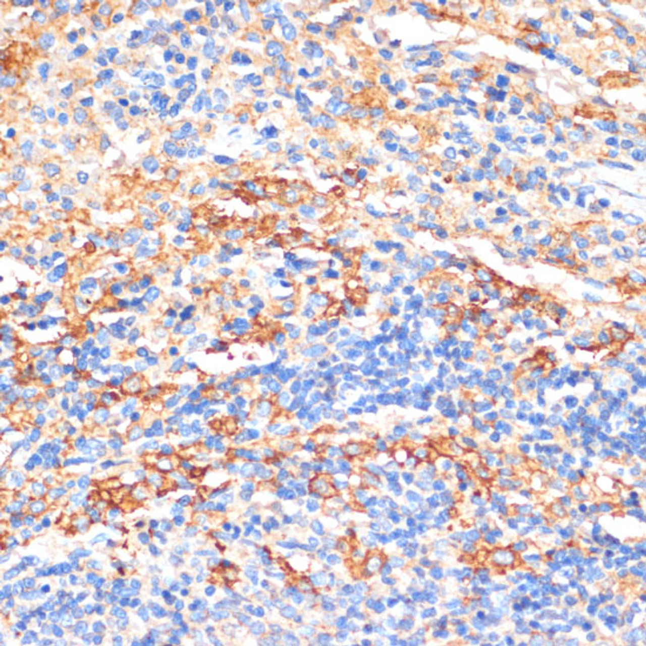 Immunohistochemistry of paraffin-embedded Rat spleen using APCS Polyclonal Antibody at dilution of  1:100 (40x lens).