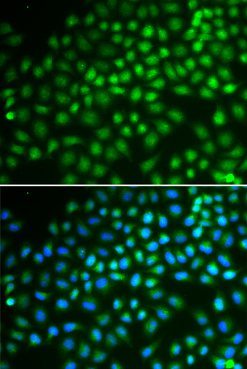 Immunofluorescence analysis of HeLa cells using SMARCA5 Polyclonal Antibody