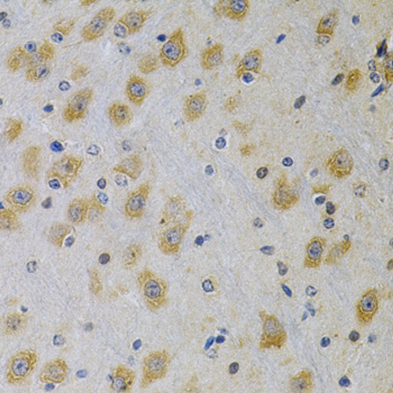 Immunohistochemistry of paraffin-embedded Rat brain using IGFBP4 Polyclonal Antibody at dilution of  1:100 (40x lens).