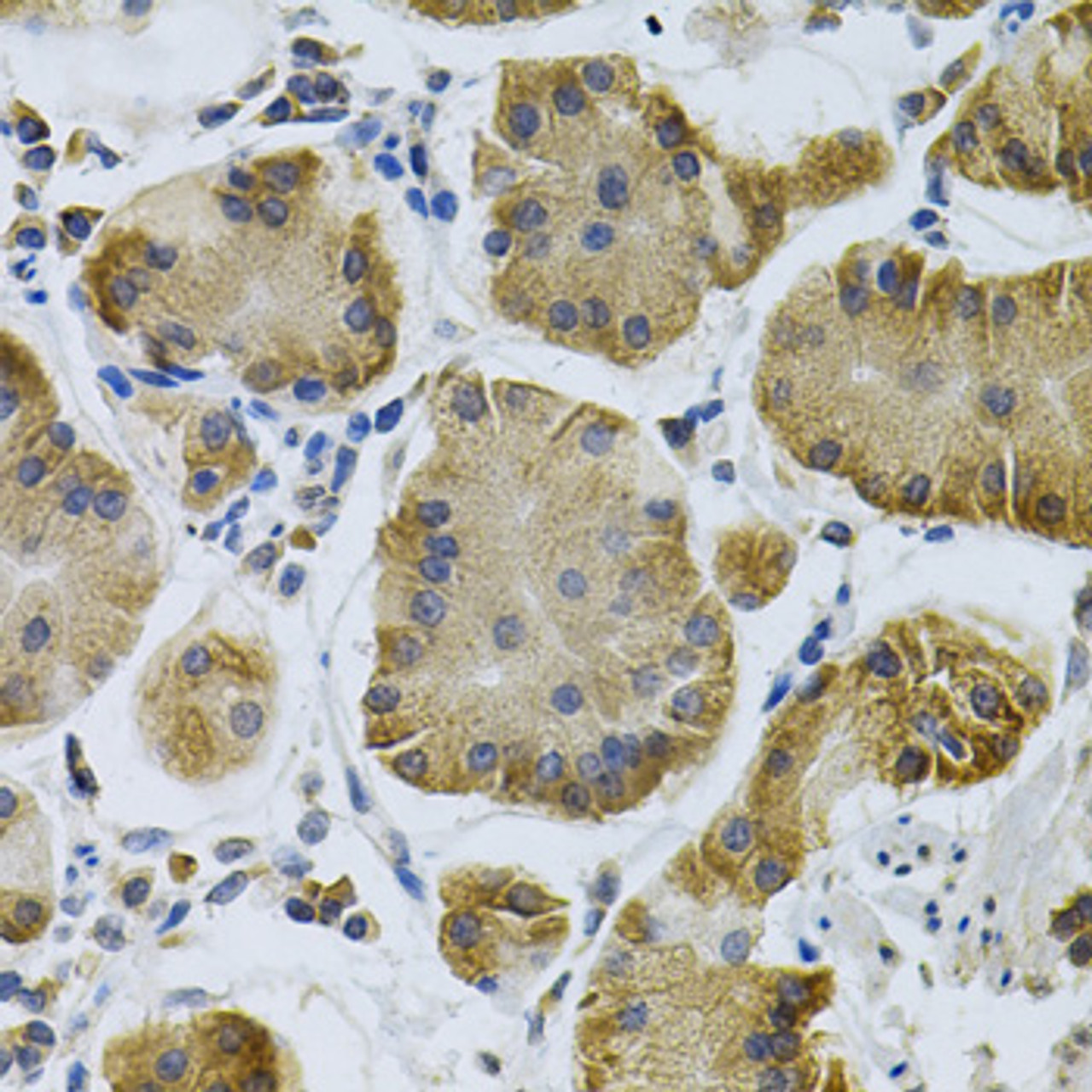 Immunohistochemistry of paraffin-embedded Human stomach using IGFBP4 Polyclonal Antibody at dilution of  1:100 (40x lens).