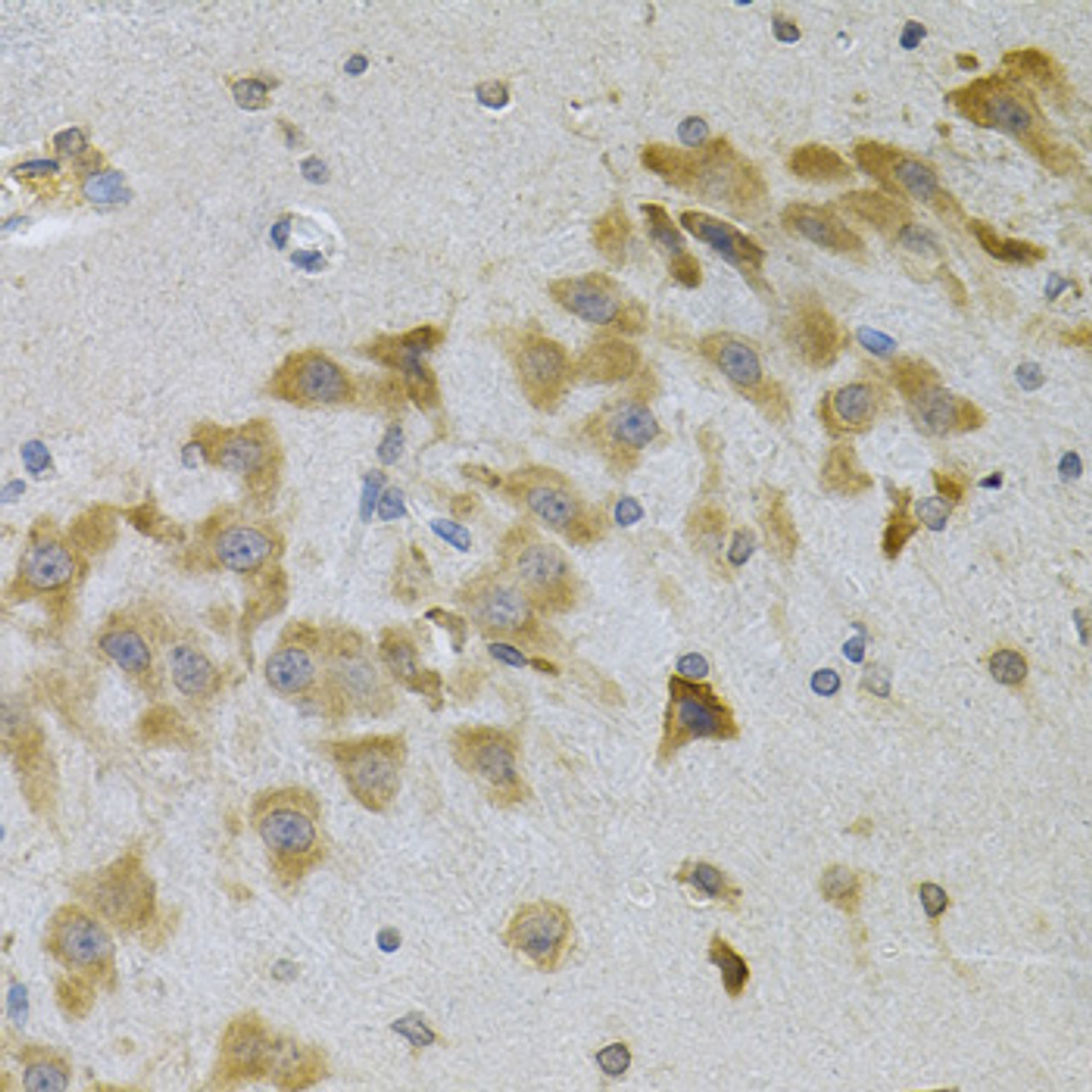 Immunohistochemistry of paraffin-embedded Mouse brain using IGFBP4 Polyclonal Antibody at dilution of  1:100 (40x lens).