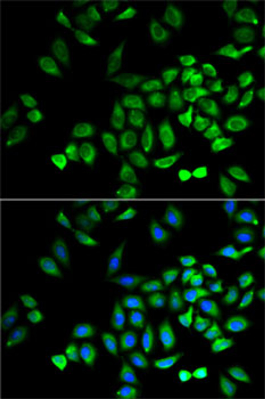 Immunofluorescence analysis of A-549 cells using ANGPTL4 Polyclonal Antibody