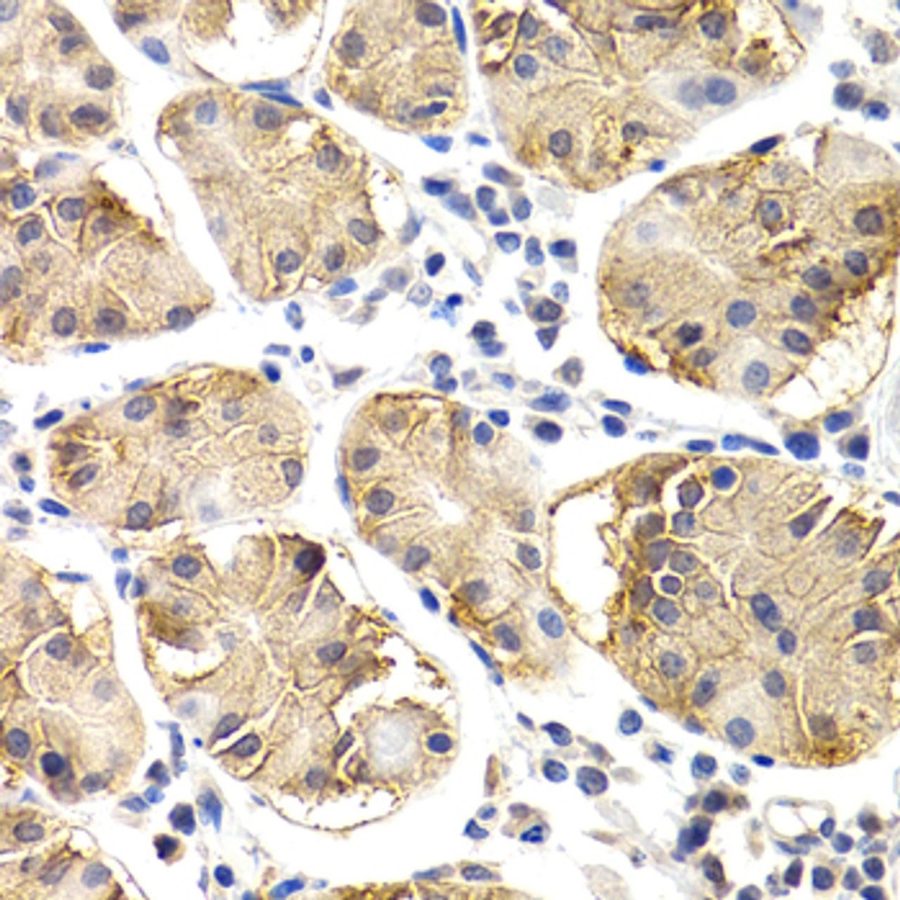 Immunohistochemistry of paraffin-embedded Human normal stomach using CHIT1 Polyclonal Antibody at dilution of  1:200 (40x lens).