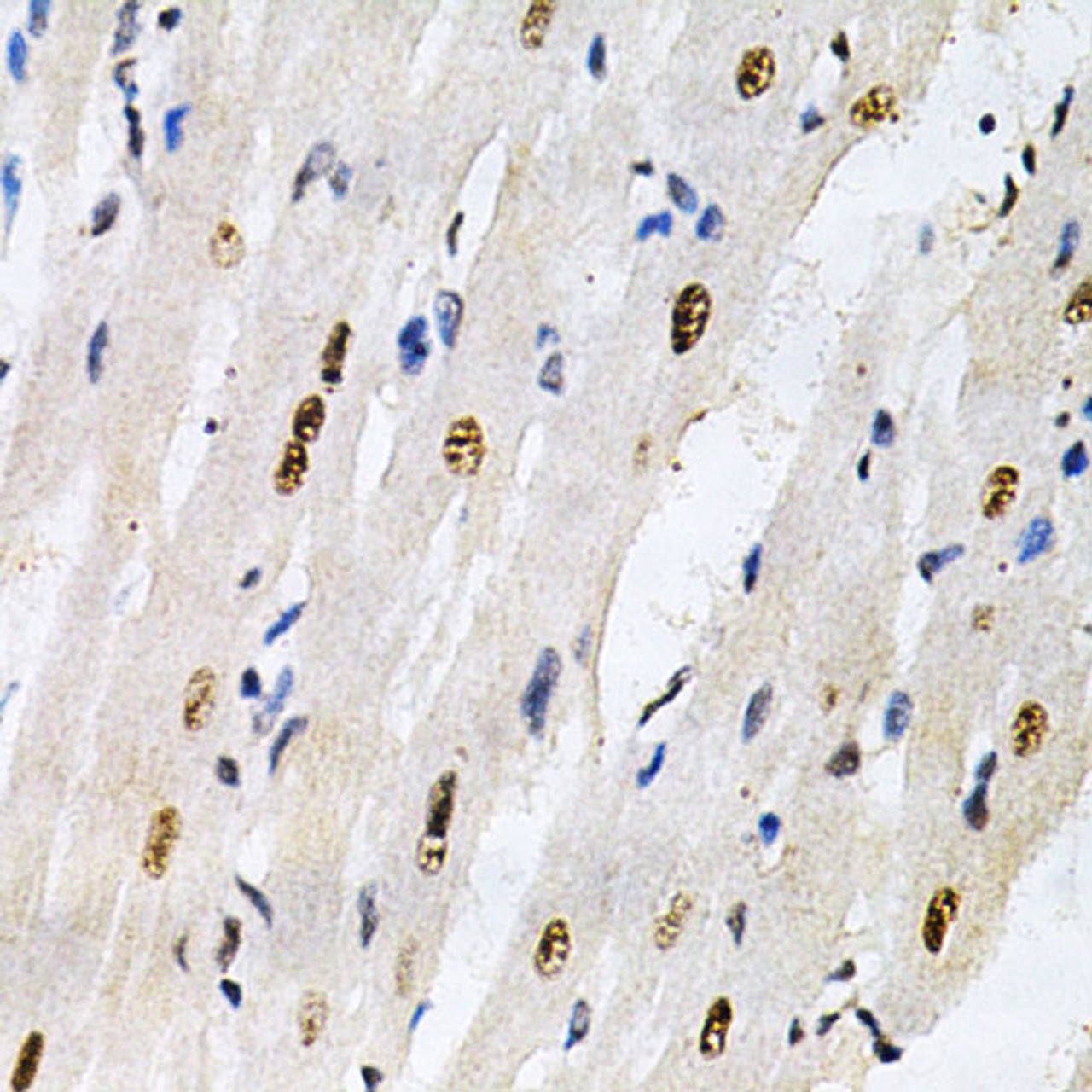 Immunohistochemistry of paraffin-embedded Rat heart using KPNA4 Polyclonal Antibody at dilution of  1:200 (40x lens).
