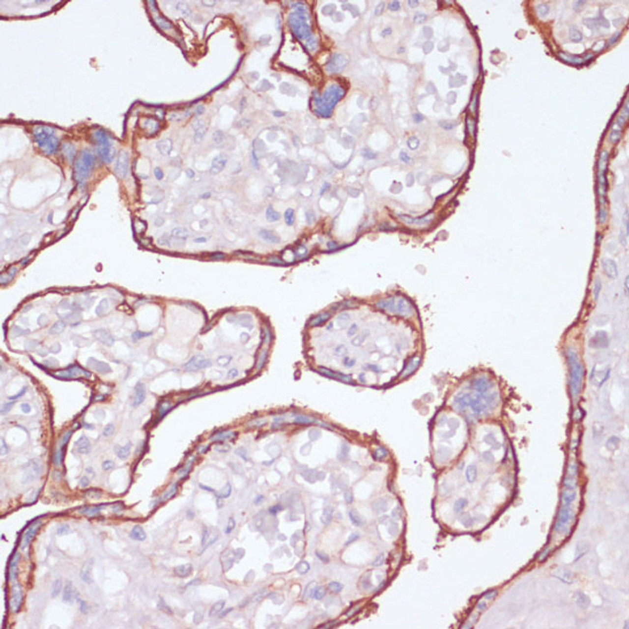 Immunohistochemistry of paraffin-embedded Human placenta using NT5E / CD73 Polyclonal Antibody at dilution of  1:200 (40x lens).