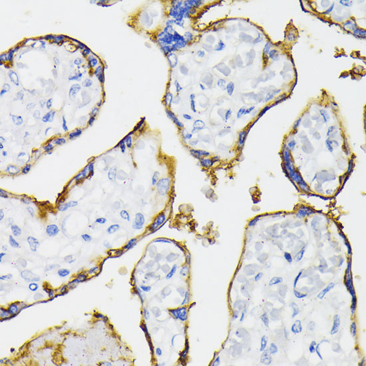 Immunohistochemistry of paraffin-embedded Human placenta using NT5E / CD73 Polyclonal Antibody at dilution of  1:200 (40x lens).