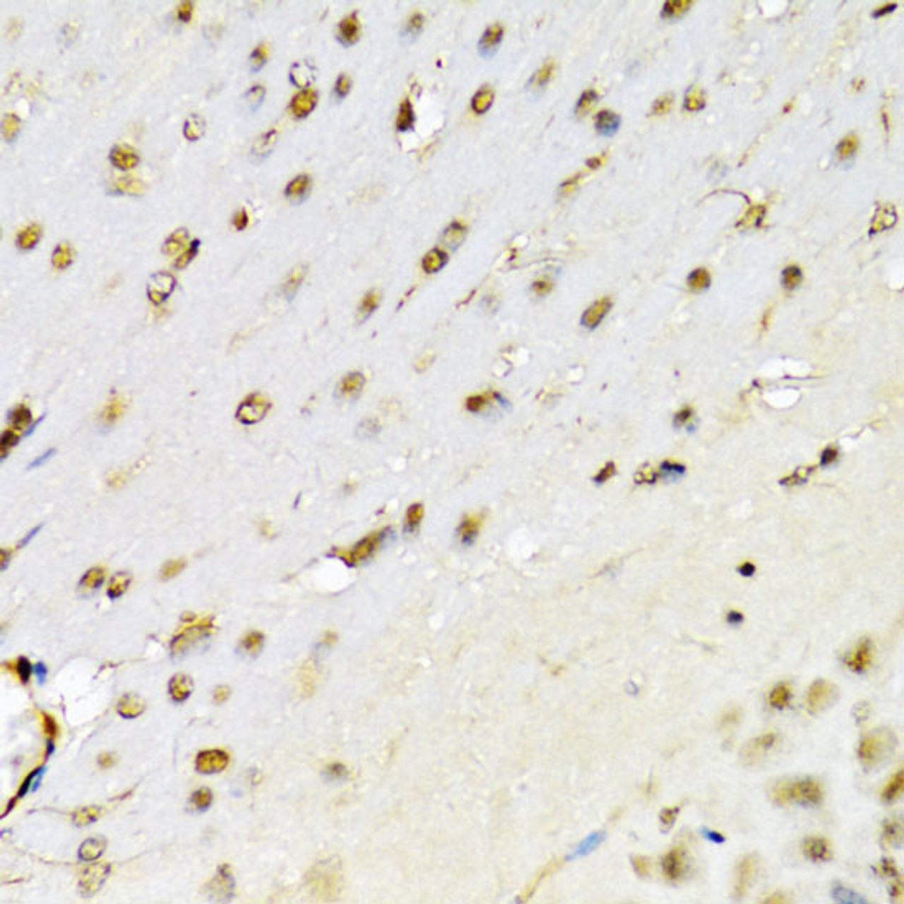 Immunohistochemistry of paraffin-embedded Mouse brain using RUNX1 Polyclonal Antibody at dilution of  1:100 (40x lens).