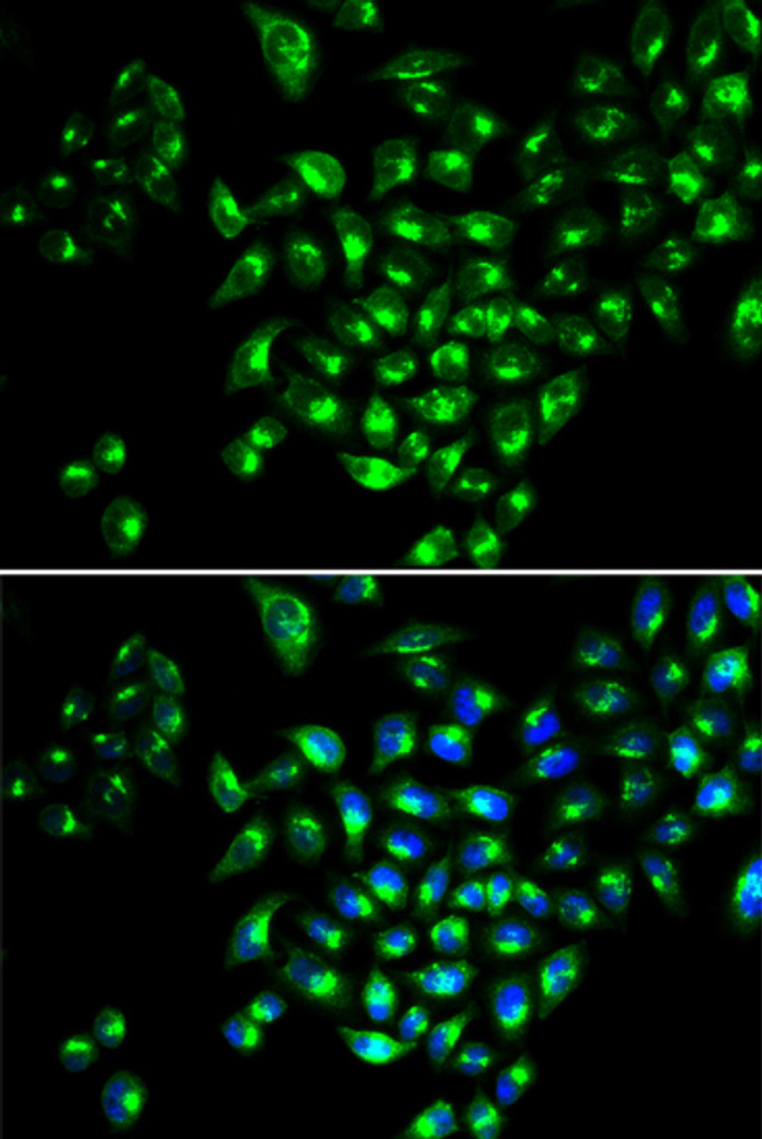 Immunofluorescence analysis of MCF-7 cells using RUNX1 Polyclonal Antibody
