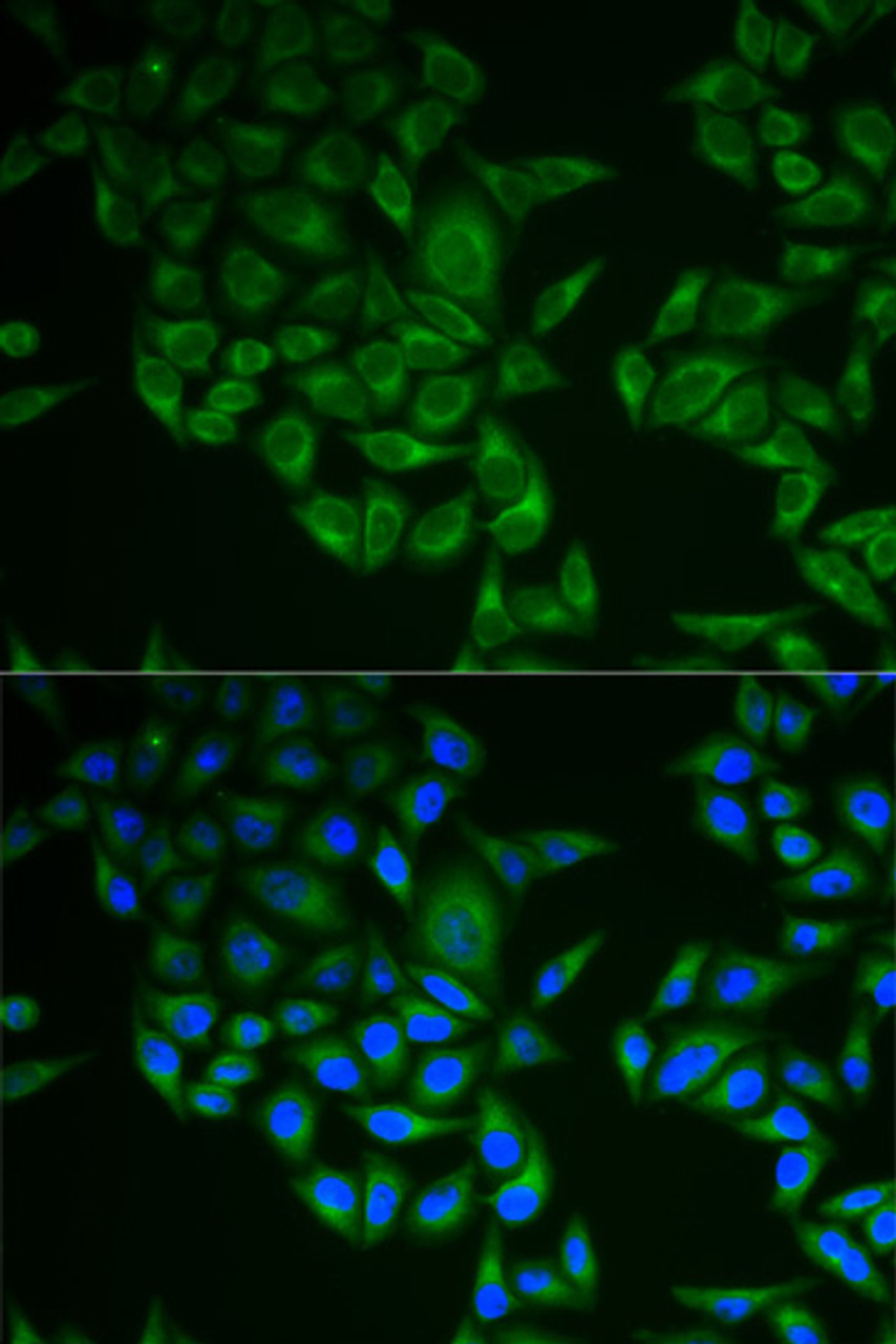 Immunofluorescence analysis of A549 cells using CD247 Polyclonal Antibody