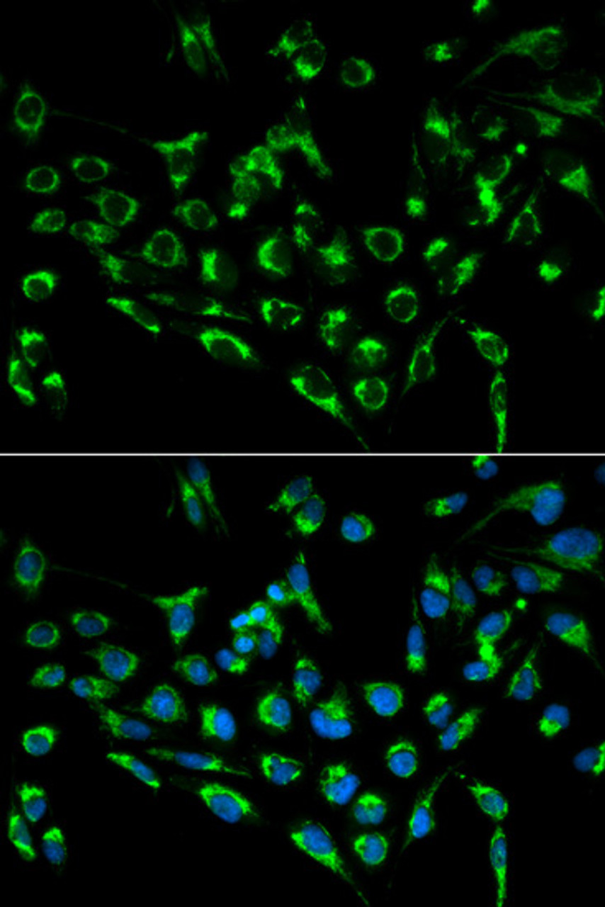 Immunofluorescence analysis of MCF-7 cells using CDKN3 Polyclonal Antibody