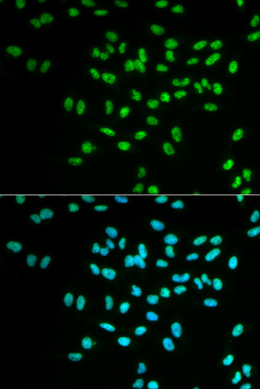 Immunofluorescence analysis of MCF-7 cells using FANCD2 Polyclonal Antibody