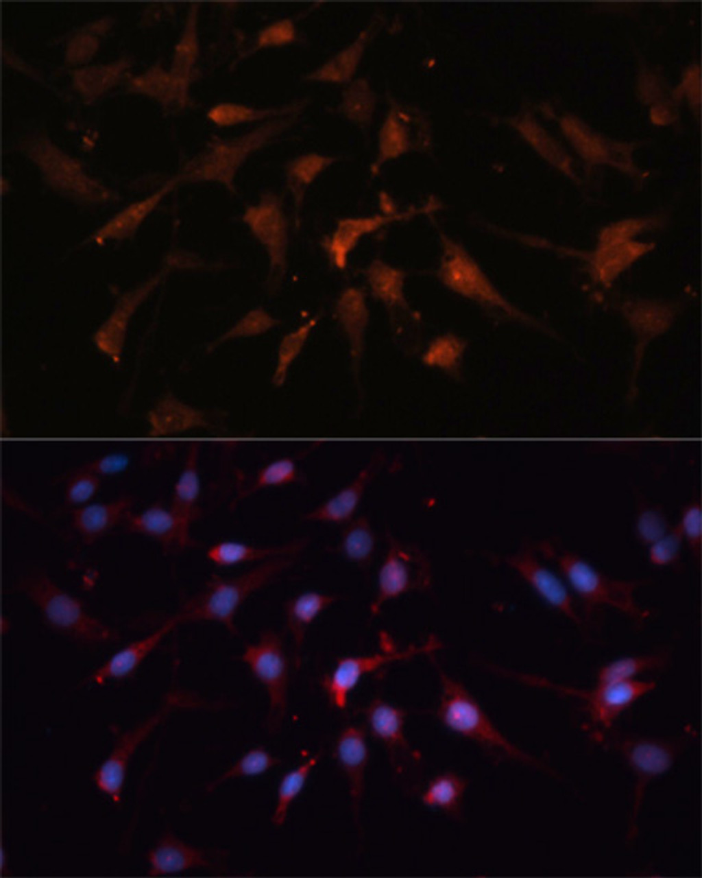 Immunofluorescence analysis of C6 cells using GSK3B Polyclonal Antibody at dilution of  1:100. Blue: DAPI for nuclear staining.