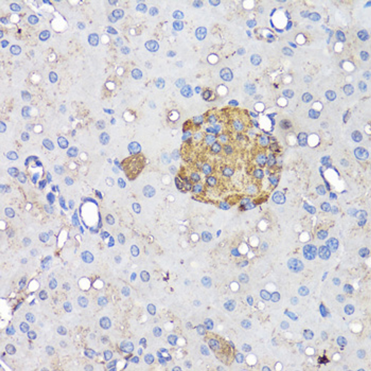 Immunohistochemistry of paraffin-embedded Mouse pancreatic islet using INS Polyclonal Antibody at dilution of  1:50 (40x lens).