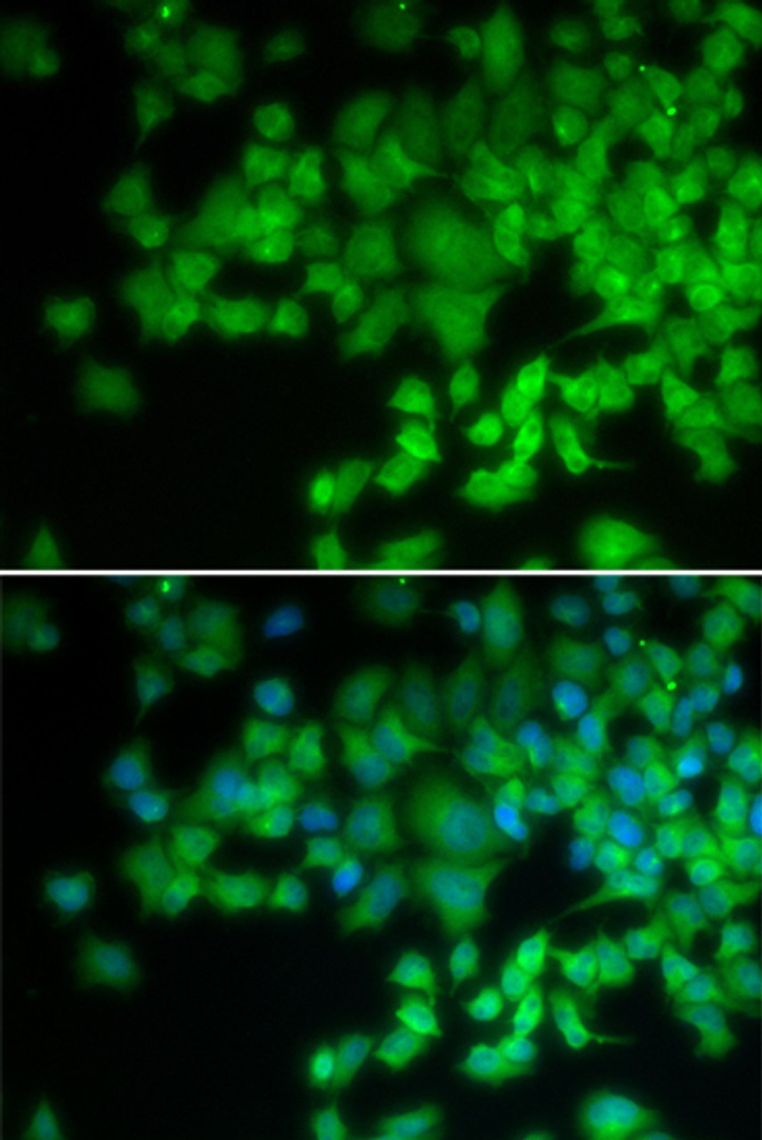 Immunofluorescence analysis of U2OS cells using NCF4 Polyclonal Antibody